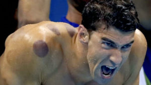 Phelps cupping Rio Olympics